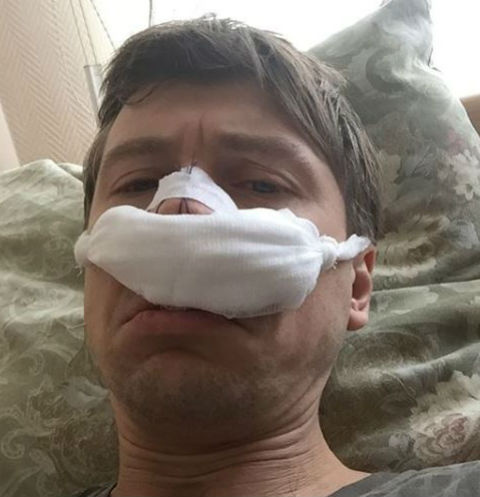 Несмотря на травму, фигурист не падает духом Несмотря на травму, фигурист не падает духом