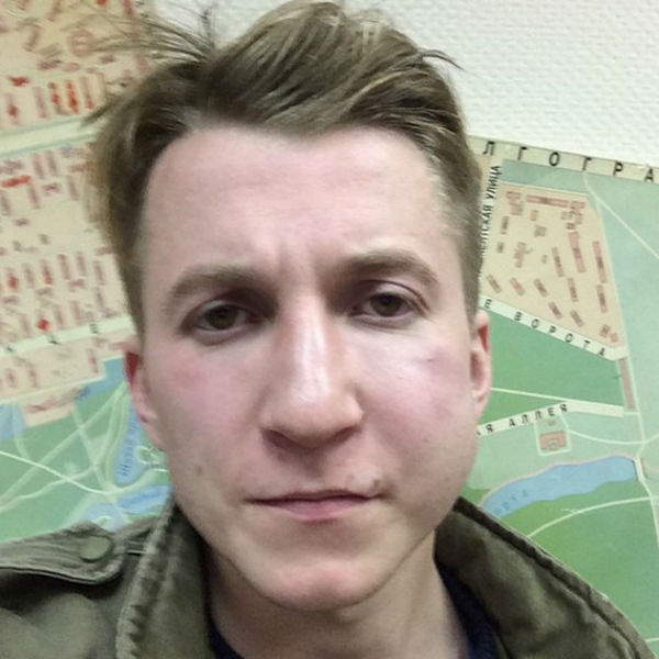 После избиения артист пожаловался поклонникам на плохое самочувствие После избиения артист пожаловался поклонникам на плохое самочувствие
