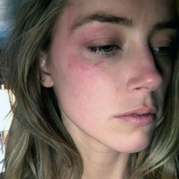 Эмбер не стала терпеть побои супруга Эмбер не стала терпеть побои супруга