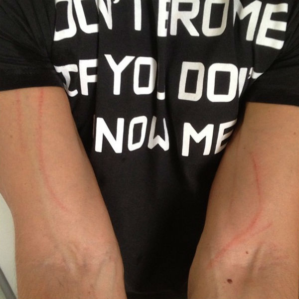 Дейзи так радовалась появлению Сергея, что даже оцарапала своего хозяина, пытаясь облизать его с головы до ног Дейзи так радовалась появлению Сергея, что даже оцарапала своего хозяина, пытаясь облизать его с головы до ног