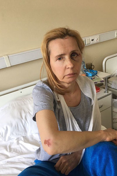 После жестокого избиения Людмила Мосейко несколько недель провела в больнице После жестокого избиения Людмила Мосейко несколько недель провела в больнице