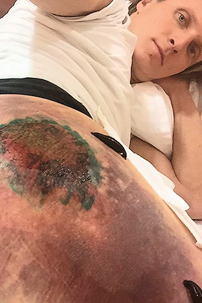 Конькобежец несколько дней провел в больнице из-за сильного повреждения ноги Конькобежец несколько дней провел в больнице из-за сильного повреждения ноги