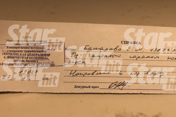 Актер сломал жене нос Актер сломал жене нос
