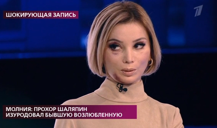 Гудзева получила травмы на лице