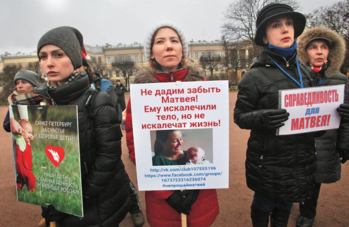 После происшествия медсестре, проводившей процедуру фототерапии, предъявляли обвинение в причинении тяжкого вреда по неосторожности. Но дело закрыли по амнистии к 70-летию Победы в Великой Отечественной войне После происшествия медсестре, проводившей процедуру фототерапии, предъявляли обвинение в причинении тяжкого вреда по неосторожности. Но дело закрыли по амнистии к 70-летию Победы в Великой Отечественной войне