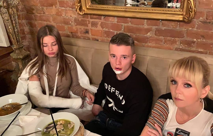 Арсениий разбил лицо