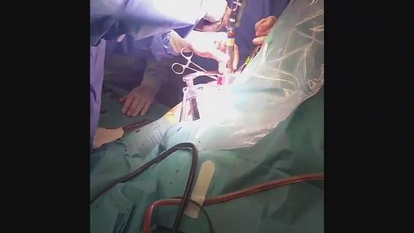 Шепс перенес операцию после того, как получил травму на съемках 