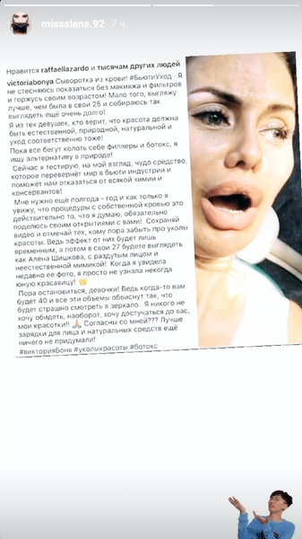 Модель опубликовала неудачный снимок теледивы