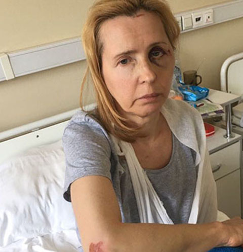 Бывший щеф-редактор программы «Взгляд» Людмила Мосейко восстанавливается после жестокого избиения