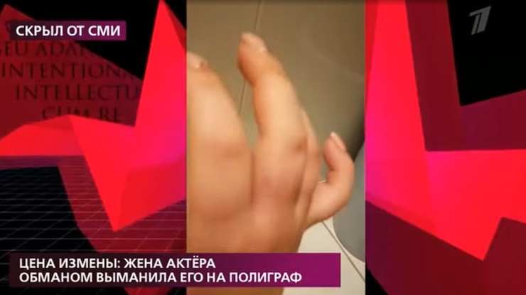 Никиткина показала покалеченные пальцы