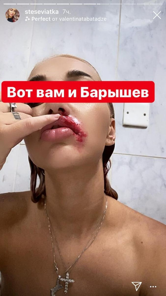 Стецевят в шоке от поведения Никиты Стецевят в шоке от поведения Никиты